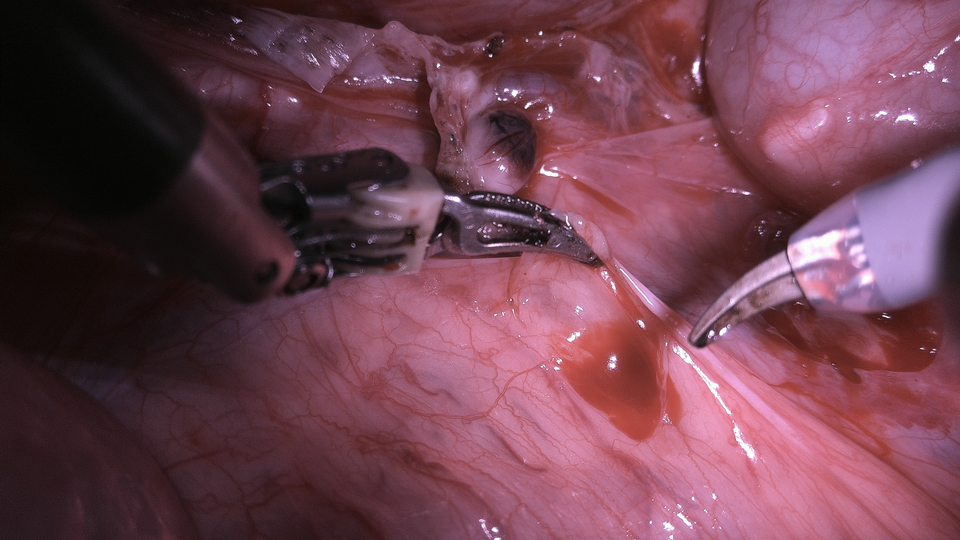 Medium Resolution - 2 Tools